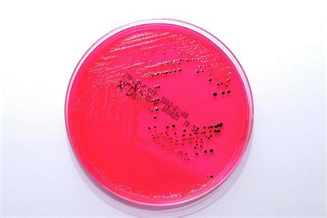 Salmonella Bacterial Culture By Cc Studio Science Photo Library