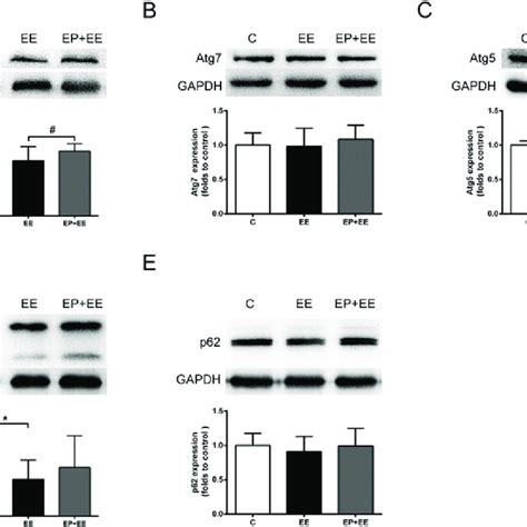 Figure Changes In Autophagy Level In Rat Myocardium During