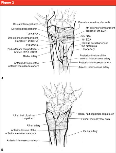 Figure 2 From Management Of Nonunion Following Surgical Management Of