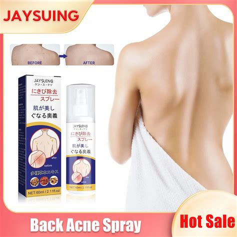 Back Acne Treatment Spray Moisturizing Repair Sooth Remove Whiteheads