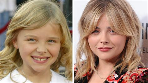 Chloe Grace Moretz S Plastic Surgery The Untold Truth