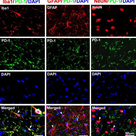 Double Immunofluorescence Showing Pd 1iba1 Pd 1gfap Download