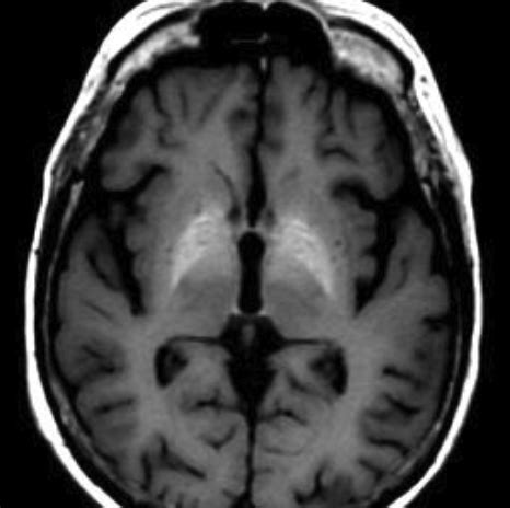 Question 76 MRI Online