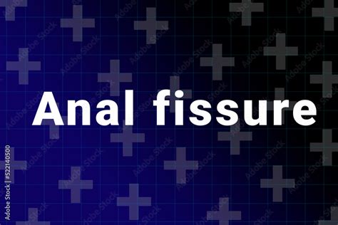 Ilustra O Do Stock Anal Fissure Disease Illustration Anal Fissure Title On Medical Background
