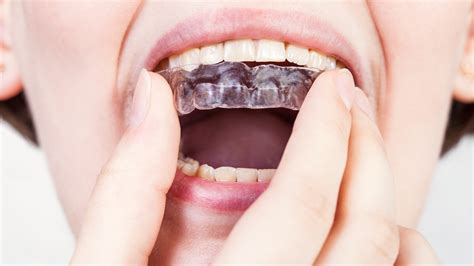 Teeth Grinding Can Hide Sleep Apnea Odotonline