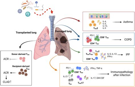 Tissue‐resident Memory T Cells And Lung Immunopathology Cheon 2023