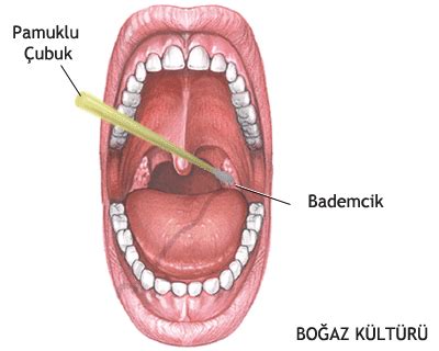 Bademcik Ltihab Belirtileri Sanal Hastane