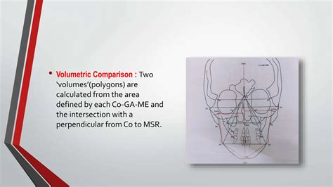 Posteroanterior Cephalometrics In Orthodonticspptx