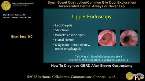 Gerd Endoscopy