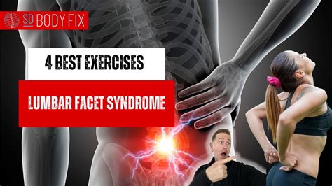 💥4 Exercises For Lumbar Facet Synrome💥 Youtube