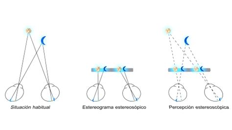 Estereopsia telas de visão e 3D Área Oftalmológica Avanzada