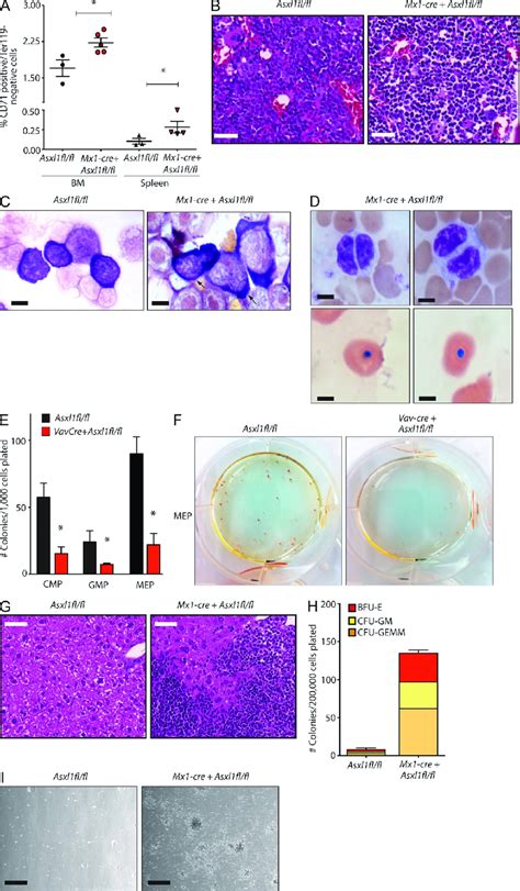 Deletion Of Asxl1 Results In Myeloid And Erythroid Dysplasia And