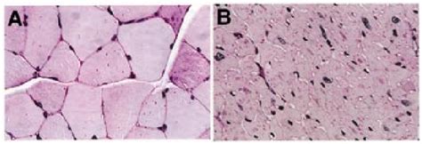 Analysis By Light Microscopy Pas Stained Sections Of Skeletal Muscle