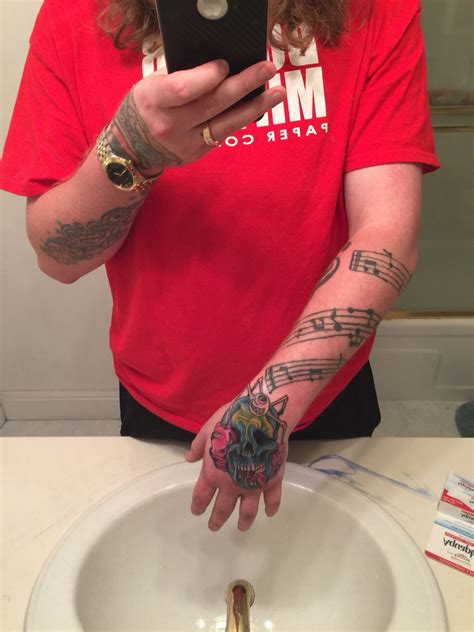 Hand Swollen After Forearm Tattoo