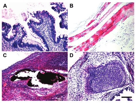 Human IPS Cells Differentiated Into Cell Types Of All Three Germ