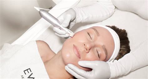 Microneedling