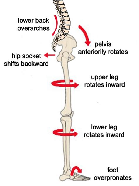 Causes Of Lower Back Pain Often Overlooked Ones