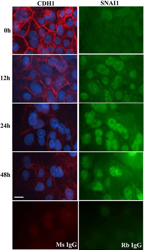 Immunofluorescence Analyses Of Cdh And Snai Protein Expression In