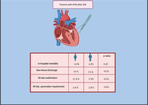 Sex Based Outcomes Of Surgical Myectomy For Hypertrophic Cardiomyopathy