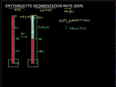 Blood Test: Esr Blood Test Results