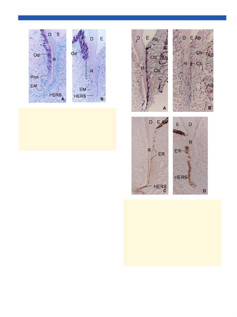 Open Access Nfic Gene Disruption Inhibits Differentiation Of