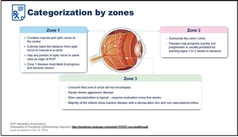 Retinopathy Of Prematurity Zones