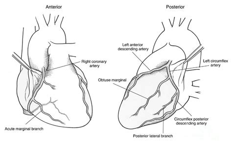 Illustration Of Coronary Arteries Photograph By Science Source