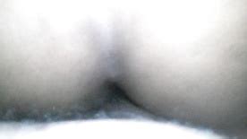 Coroa Anal Cnn Amador