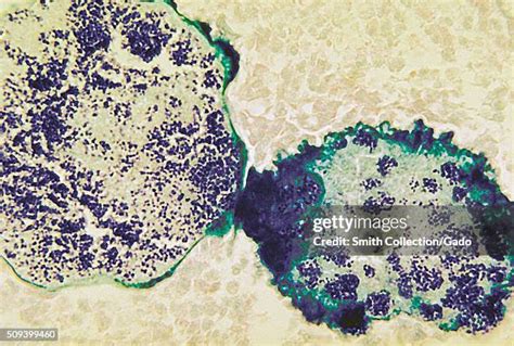 Histology Photos and Premium High Res Pictures - Getty Images