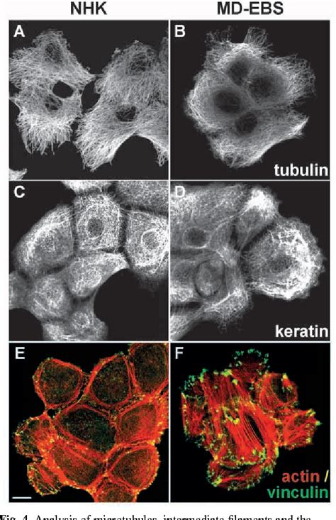 Pdf Formation Of Hemidesmosome Like Structures In The Absence Of