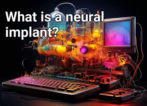 What is a neural implant? – Technology.Gov.Capital