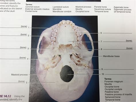 Lab Figure Inferior View Of The Skull Diagram Quizlet