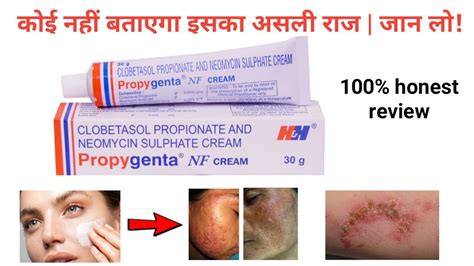 Propygenta NF Cream Honest Review 2022 Must Watch YouTube