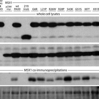 Co Immunoprecipitation Assay Of Protein Protein Interaction With MSX1