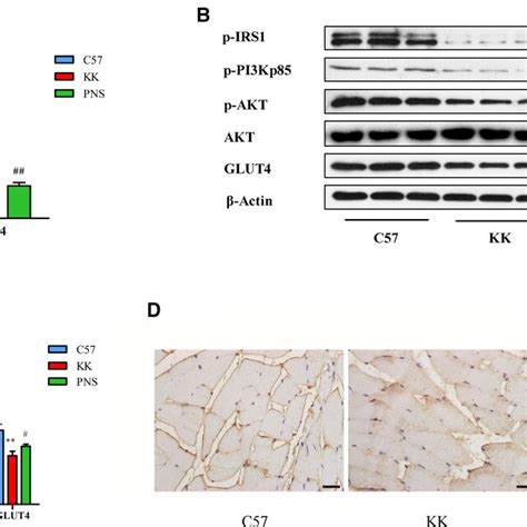 Effect Of Pns On Pirs Ppi K Pakt And Glut In Skeletal Muscle