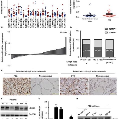 Kdm A Knockdown Inhibited Papillary Thyroid Cancer Ptc Cell Migration