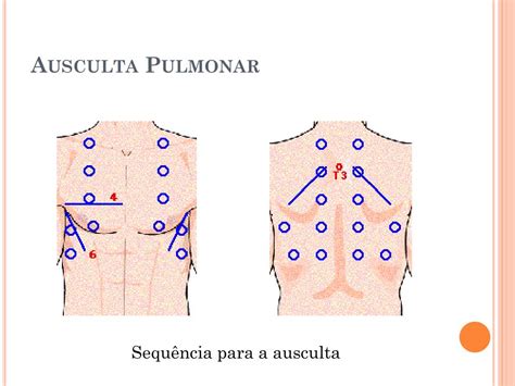 Pontos Da Ausculta Pulmonar BRAINCP