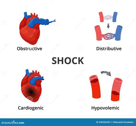 Management Of Different Types Of Shock