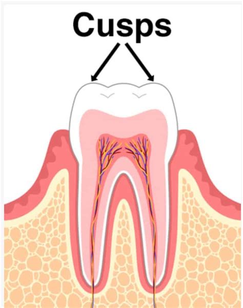 What Does Cuspal Mean In Dentistry Or Orthodontics Archwired