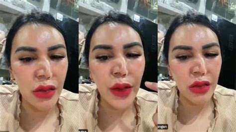 Sosok Ratu Talisha Alias Ratu Entok Viral Gegara Curhat Hidung Bengkok