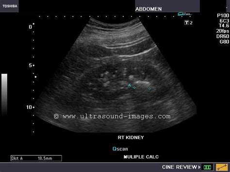 A Gallery of High-Resolution, Ultrasound, Color Doppler & 3D Images ...