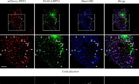 Figure 2 From Interaction Of Ubiquitin Ligase CBL With LMP2A Protein Of