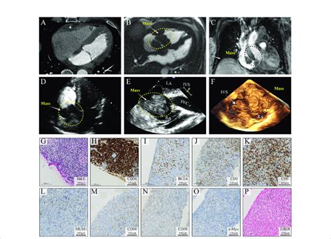 Multimodality Medical Imaging Diagnosis And Histopathological