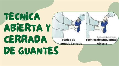 T Cnica Abierta Y Cerrada De Guantes Nini Udocz