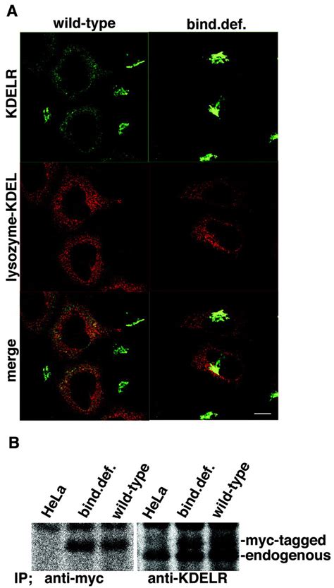 The Kdel Receptor Modulates The Endoplasmic Reticulum Stress Response Through Mitogen Activated