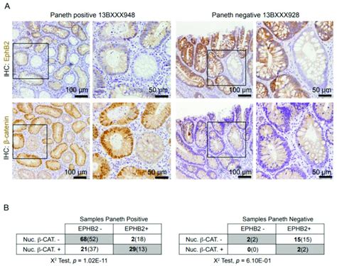 Expression of EPHB2 is linked with Wnt β catenin activation in Paneth