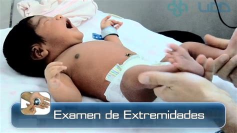 Examen De Las Extremidades Del Reci N Nacido Youtube