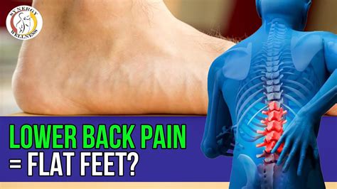 Foot Pain Knee Pain Flat Feet Could Be The Reason For Your Lower