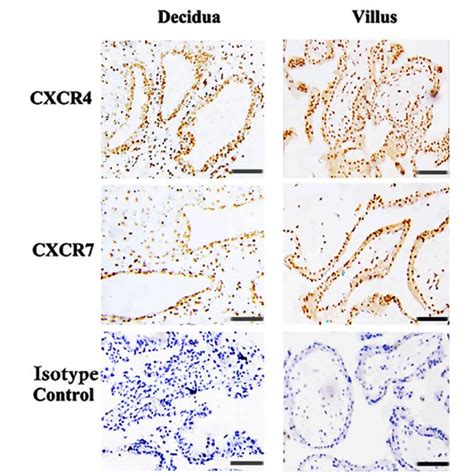 Expression Levels Of Cxcr And Cxcr In Primary Human First Trimester