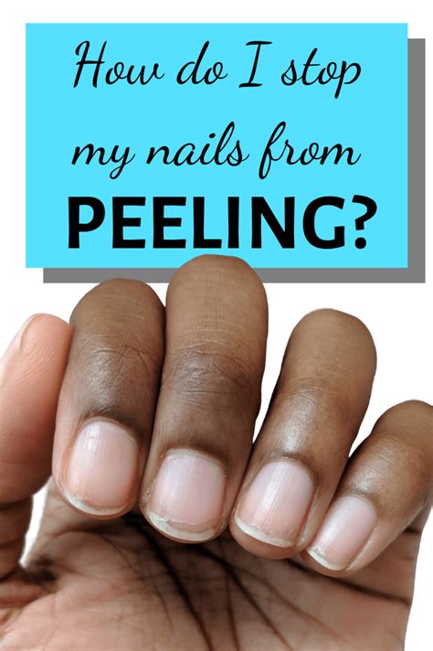 Wondering What To Do About Nails That Constantly Peel Read This Post